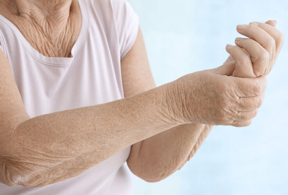 ¿Sabes diferenciar la osteoartritis de la artritis reumatoide?